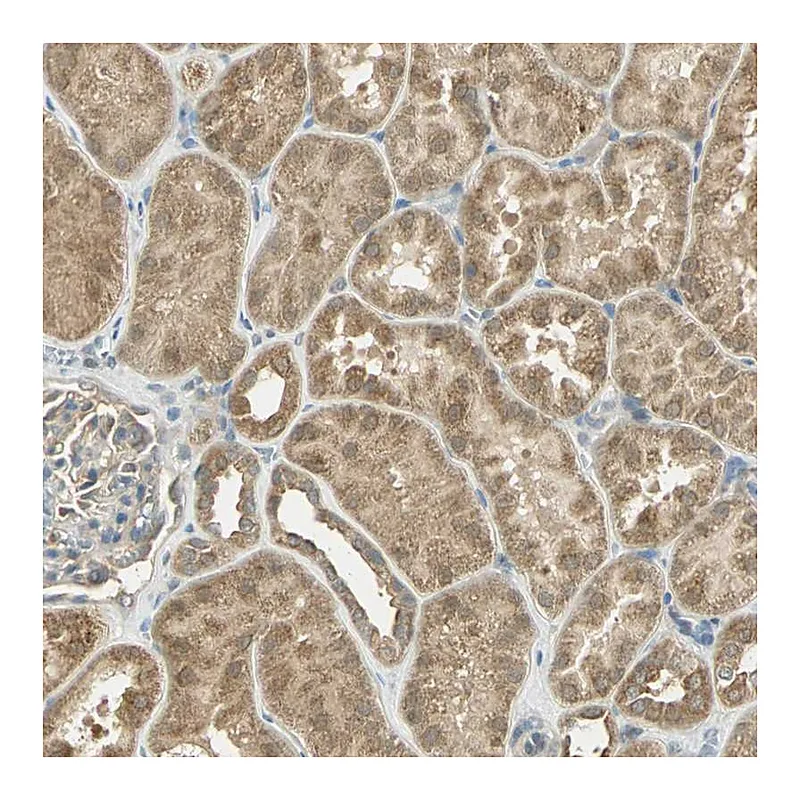 Atlas Antibodies Anti-BIRC2 Antibody