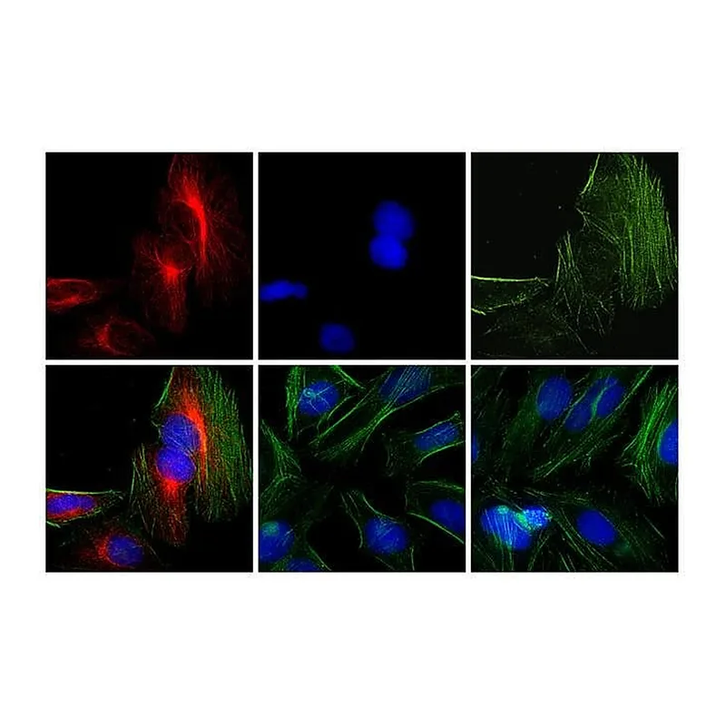 Thermo Fisher Scientific Donkey anti-Rabbit IgG (H+L) Cross-Adsorbed Secondary Antibody, Rhodamine