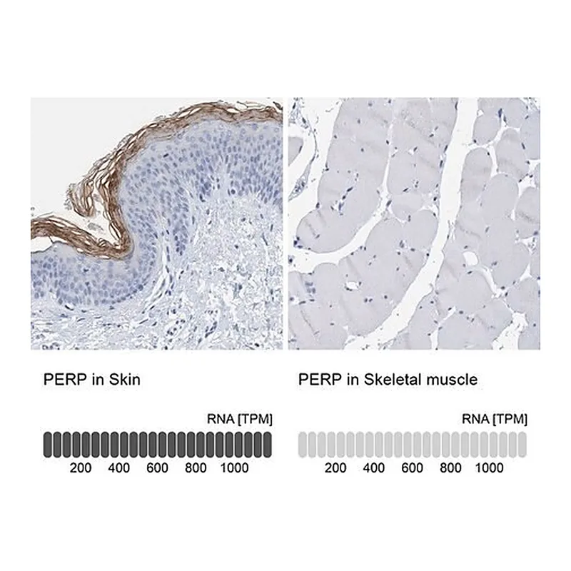 Merck Anti-PERP antibody produced in rabbit