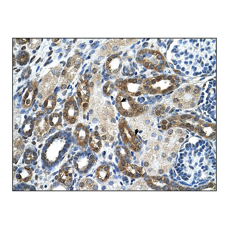 Merck Anti-PKLR antibody produced in rabbit