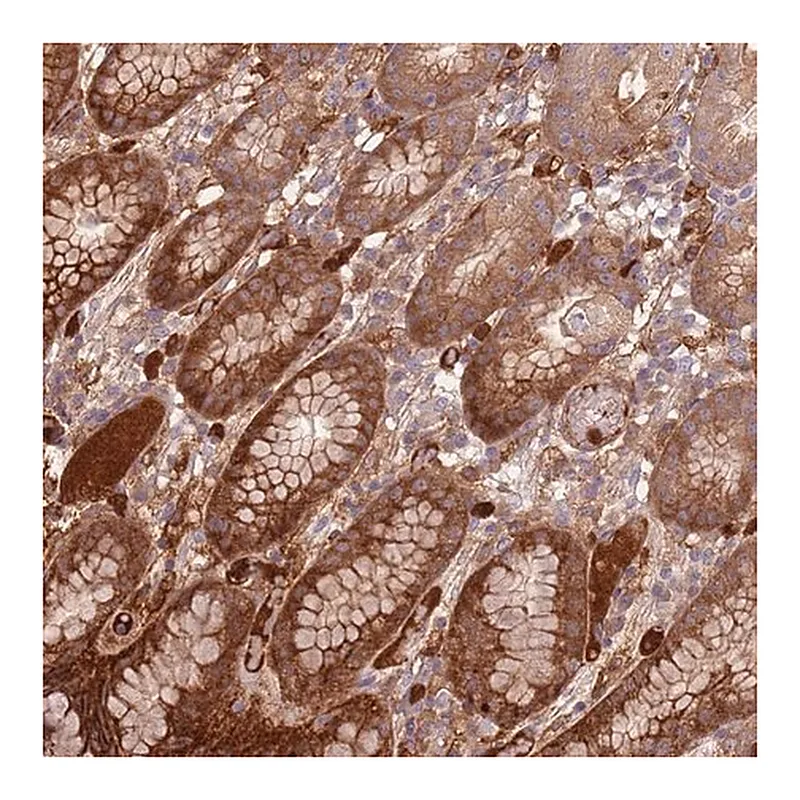 Merck Anti-NADK antibody produced in rabbit