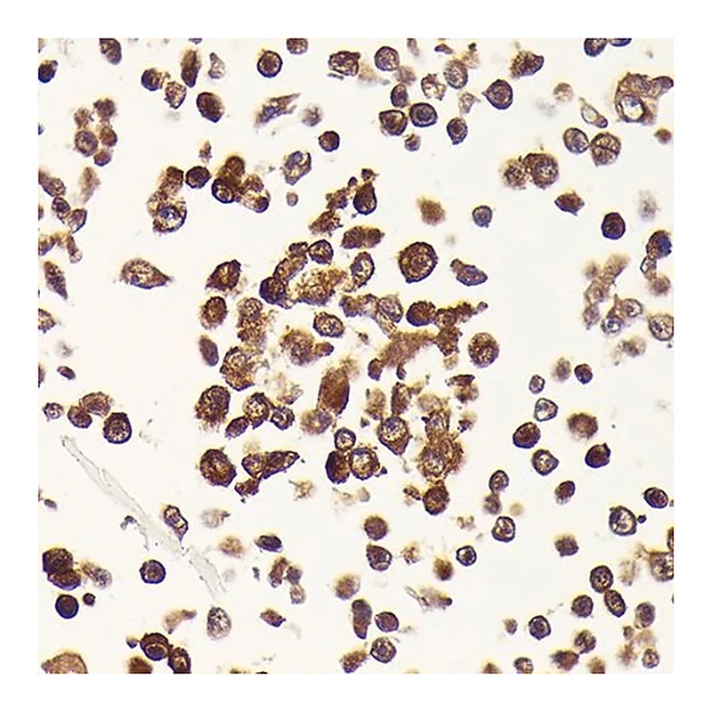 Merck Anti-CDKN2A/p16INK4a antibody produced in mouse