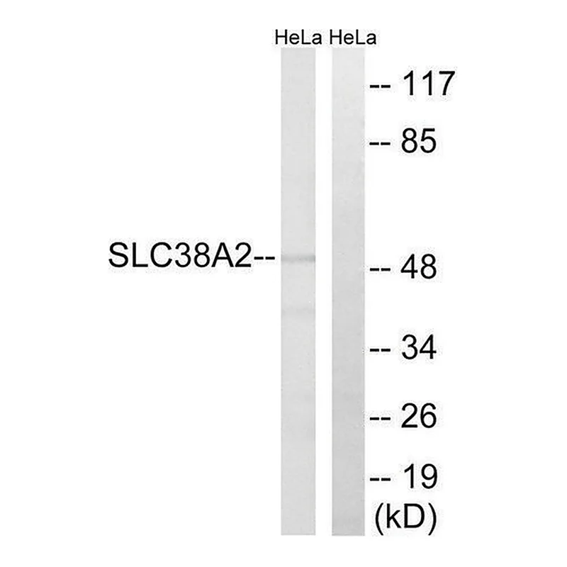 Merck Anti-SLC38A2 antibody produced in rabbit