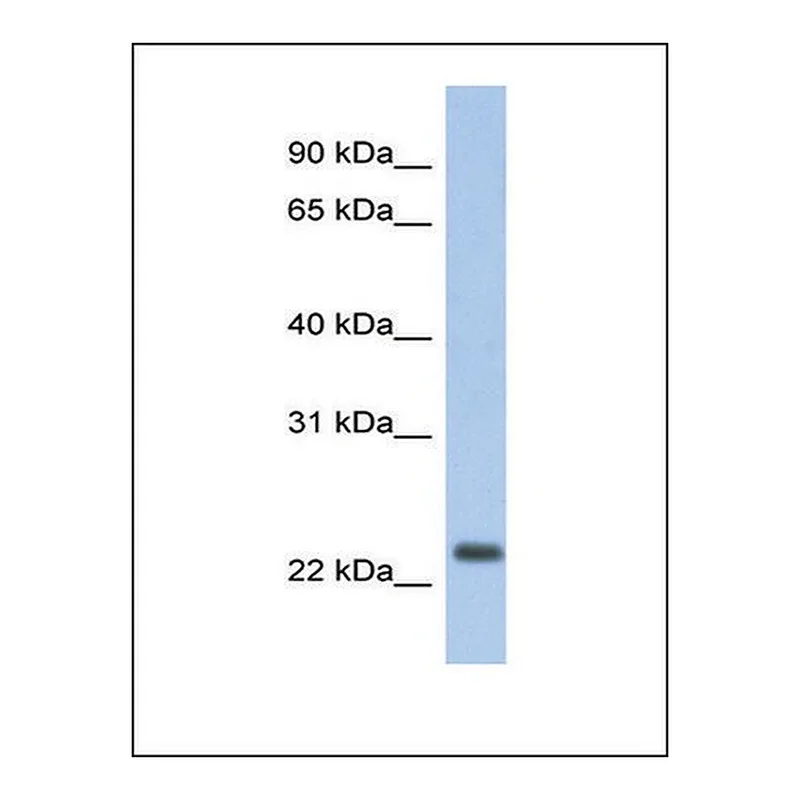 Merck Anti-ND6