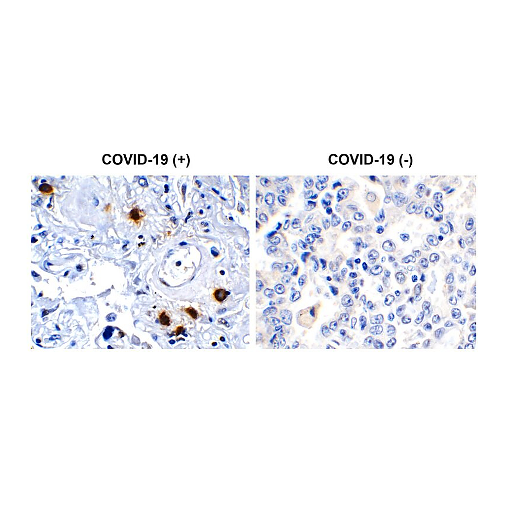 Merck Anti-SARS-CoV-2 (COVID-19) NSP7 antibody produced in rabbit
