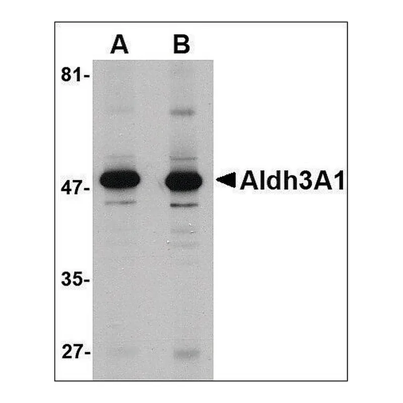 Merck Anti-ALDH3A1 antibody produced in rabbit