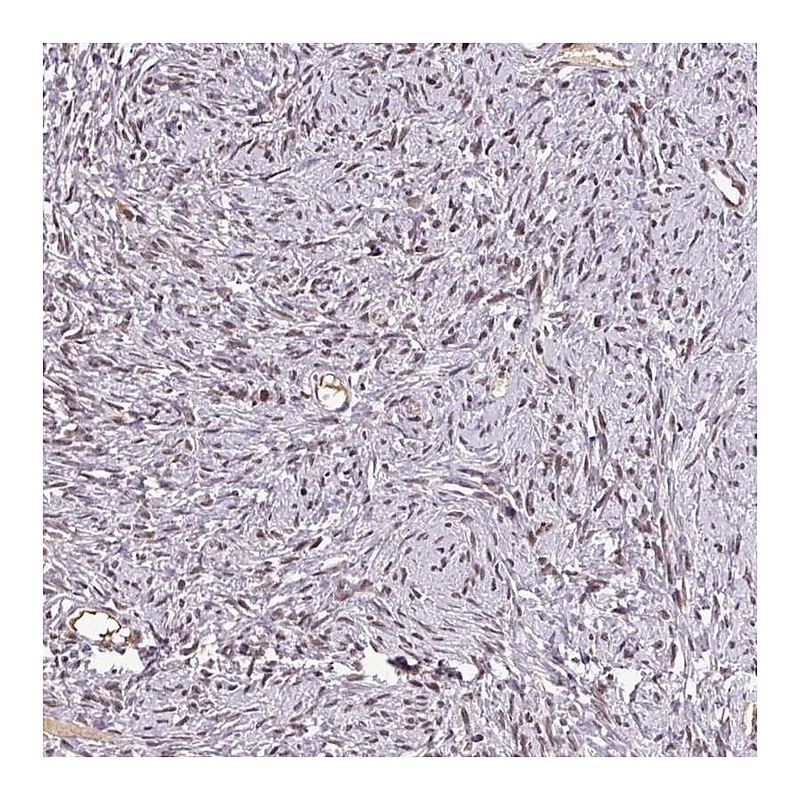 Atlas Antibodies Anti-NOB1 Antibody