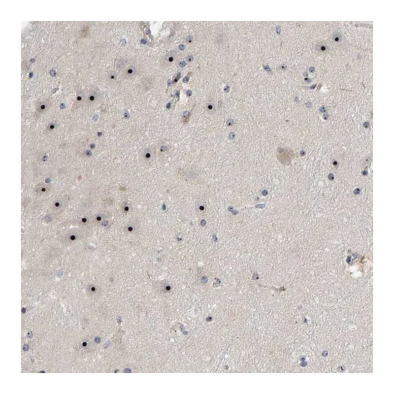 Atlas Antibodies Anti-NOL11 Antibody