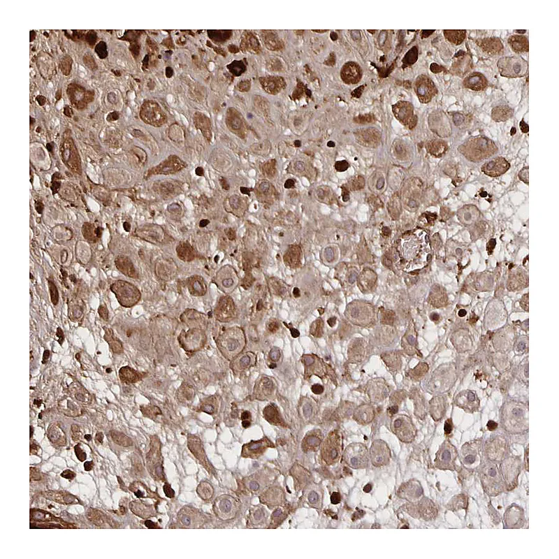 Atlas Antibodies Anti-NOG Antibody