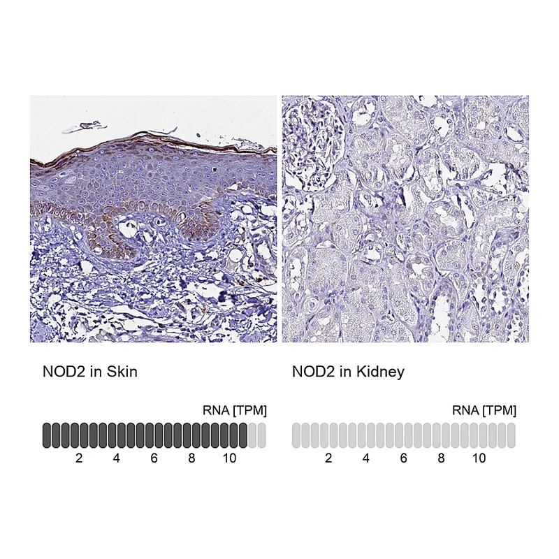 Atlas Antibodies Anti-NOD2 Antibody
