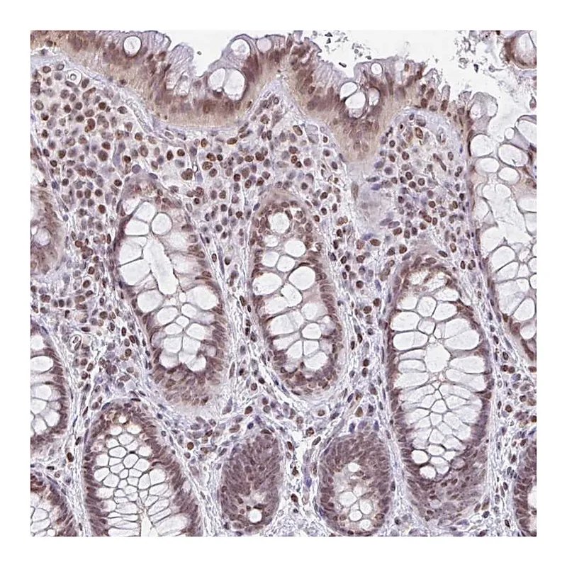 Atlas Antibodies Anti-NOL6 Antibody