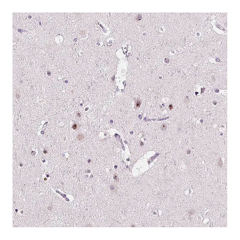 Atlas Antibodies Anti-NOLC1 Antibody