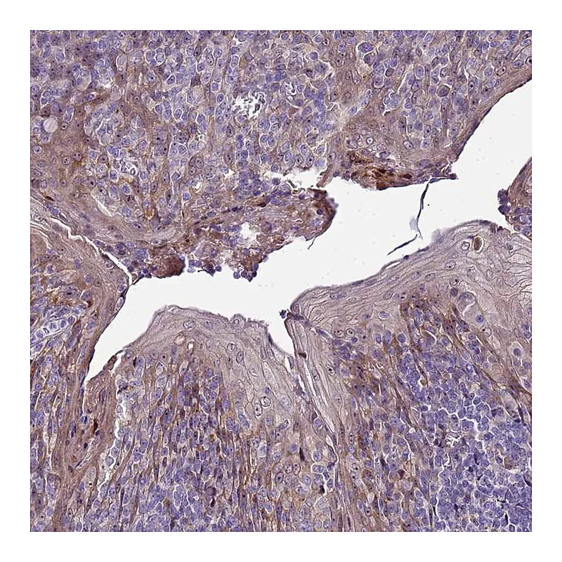 Atlas Antibodies Anti-NOL8 Antibody