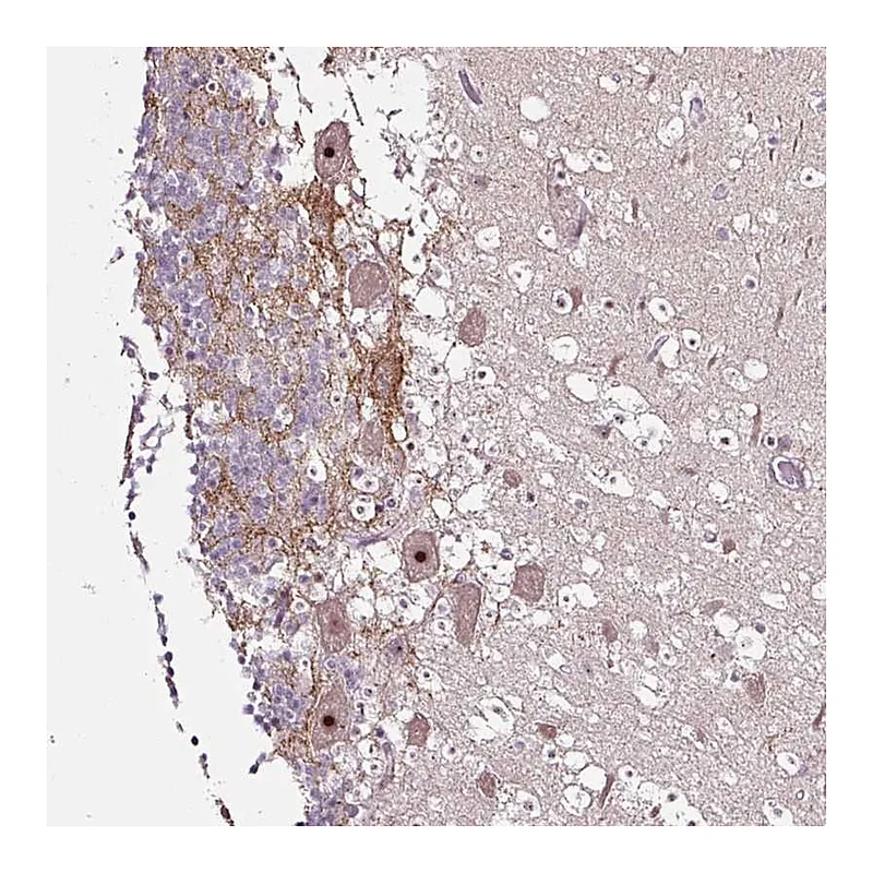 Atlas Antibodies Anti-NOM1 Antibody