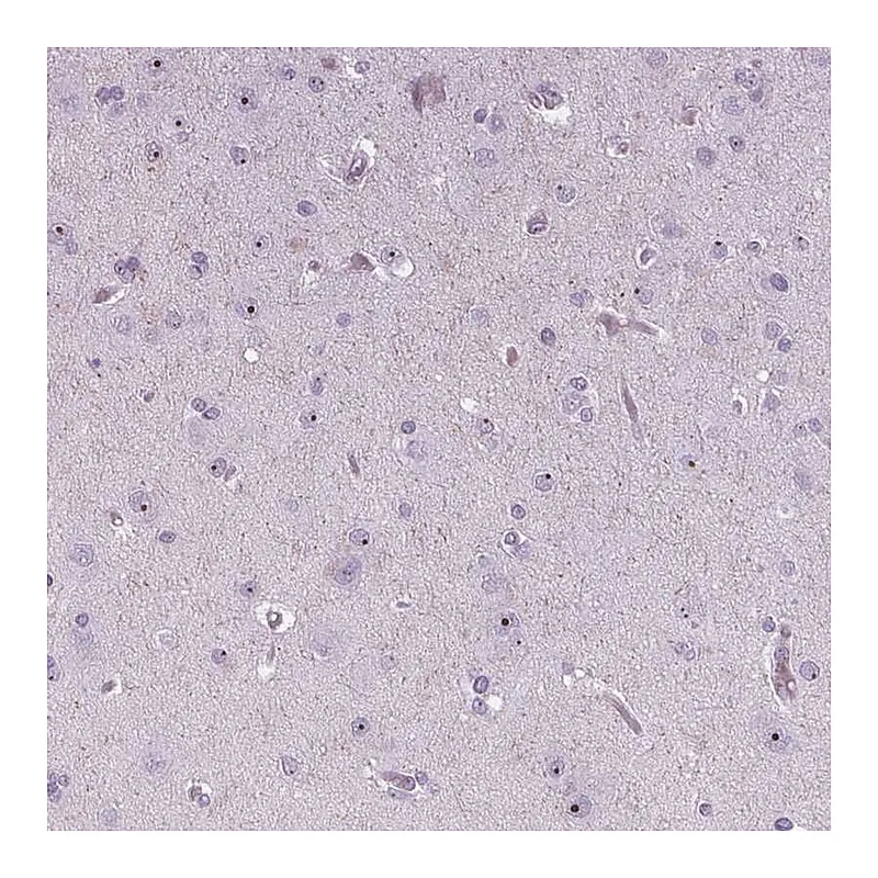 Atlas Antibodies Anti-NOLC1 Antibody