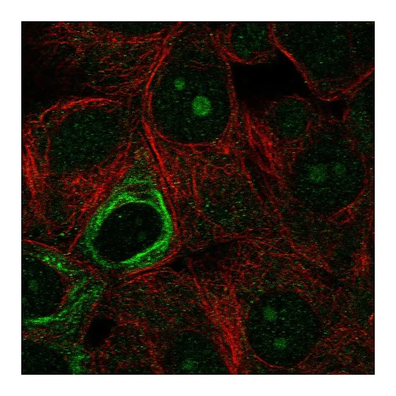 Atlas Antibodies Anti-NOL9 Antibody
