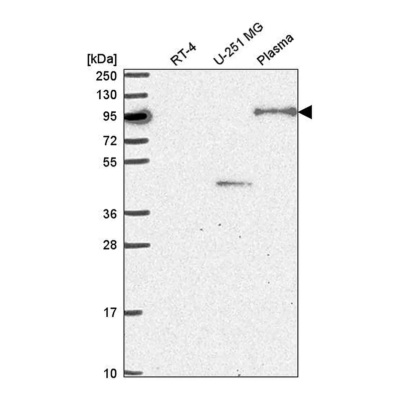 Atlas Antibodies Anti-NOM1 Antibody