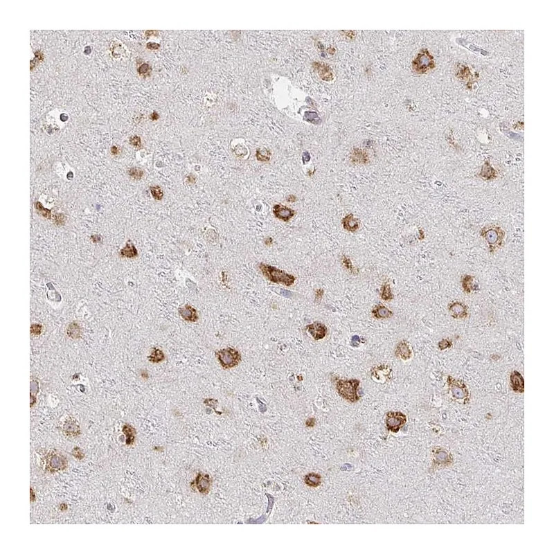 Atlas Antibodies Anti-NOMO1 Antibody
