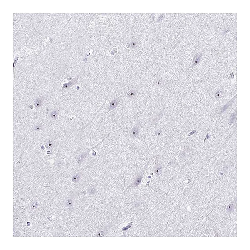 Atlas Antibodies Anti-NOP10 Antibody