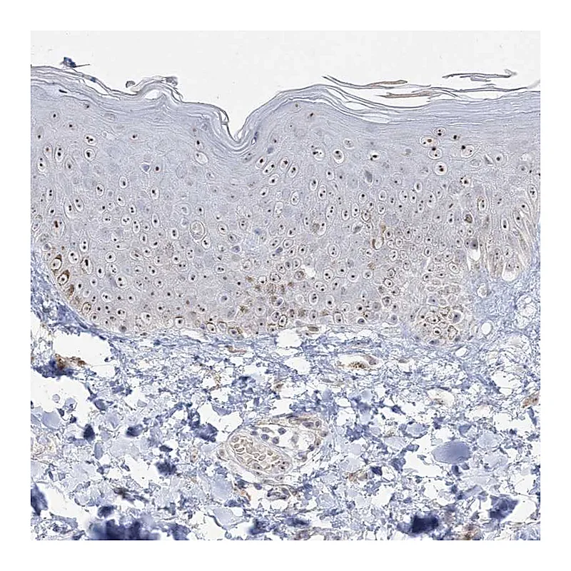 Atlas Antibodies Anti-NOP16 Antibody