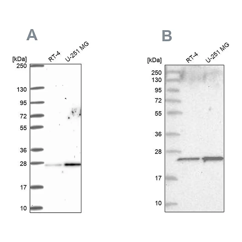 Atlas Antibodies Anti-NOP16 Antibody