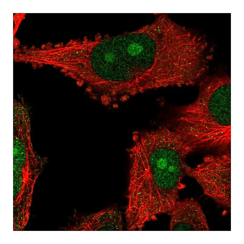 Atlas Antibodies Anti-NOP14 Antibody