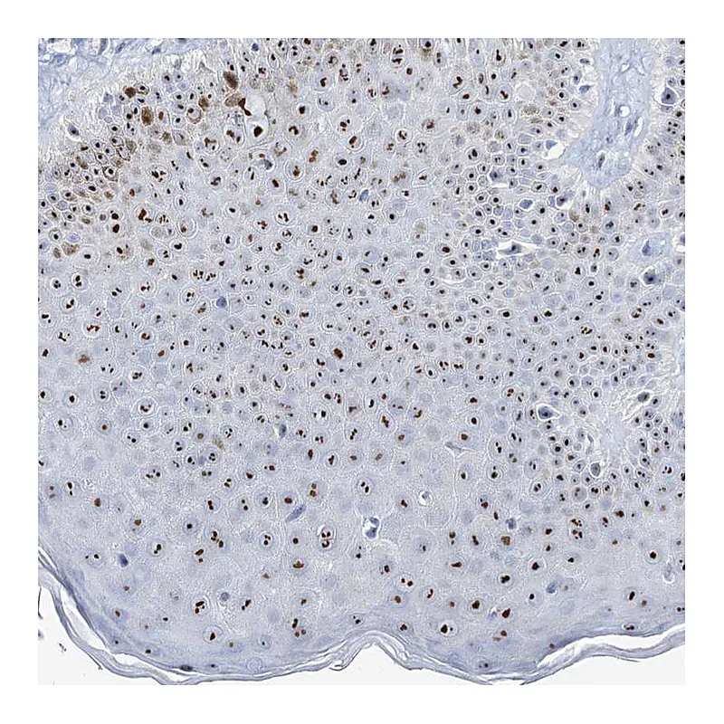 Atlas Antibodies Anti-NOP2 Antibody