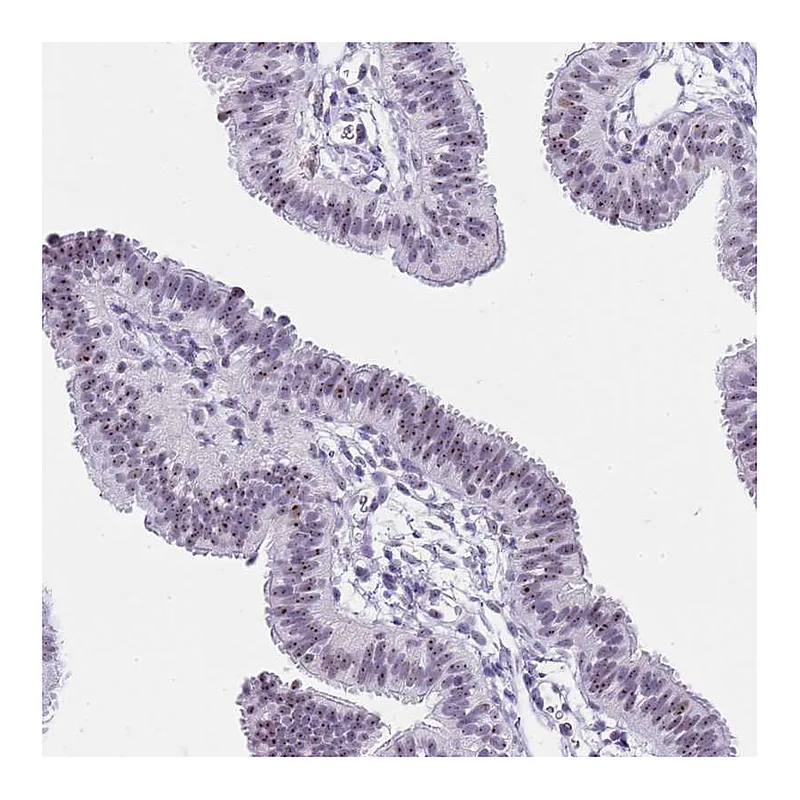Atlas Antibodies Anti-NOP56 Antibody