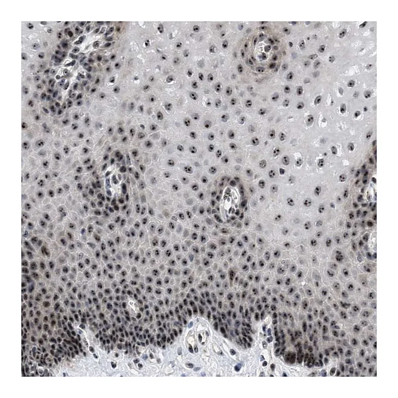 Atlas Antibodies Anti-NOP58 Antibody