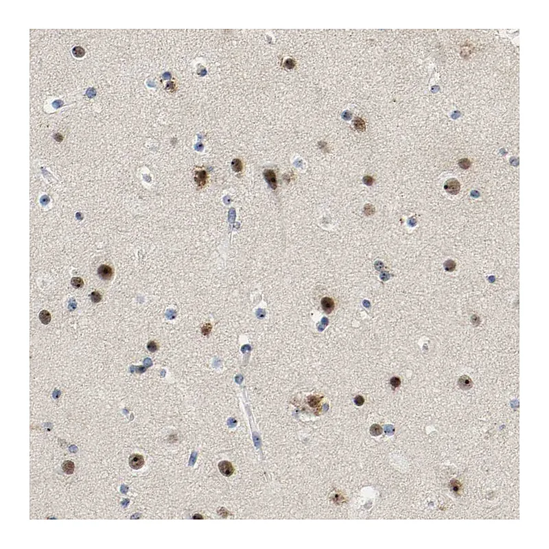 Atlas Antibodies Anti-NOP58 Antibody