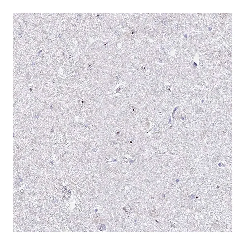 Atlas Antibodies Anti-NOP14 Antibody