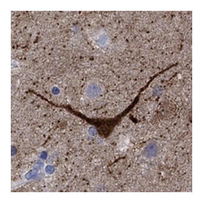 Atlas Antibodies Anti-NOS1 Antibody