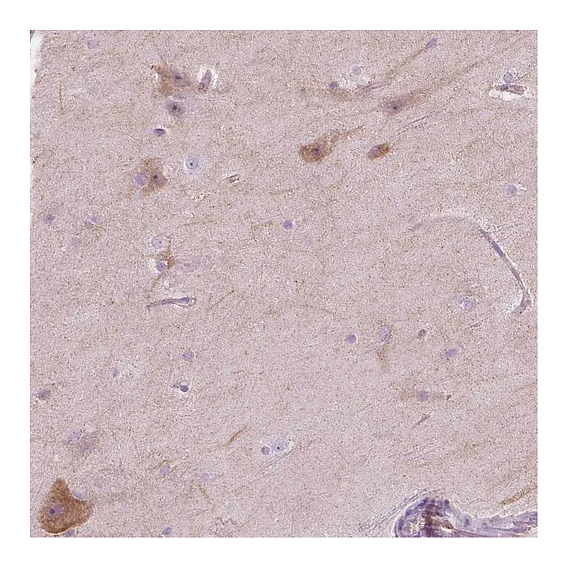 Atlas Antibodies Anti-NOS1AP Antibody