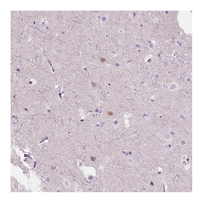 Atlas Antibodies Anti-NOS1AP Antibody