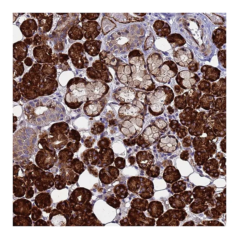 Atlas Antibodies Anti-NOSTRIN Antibody
