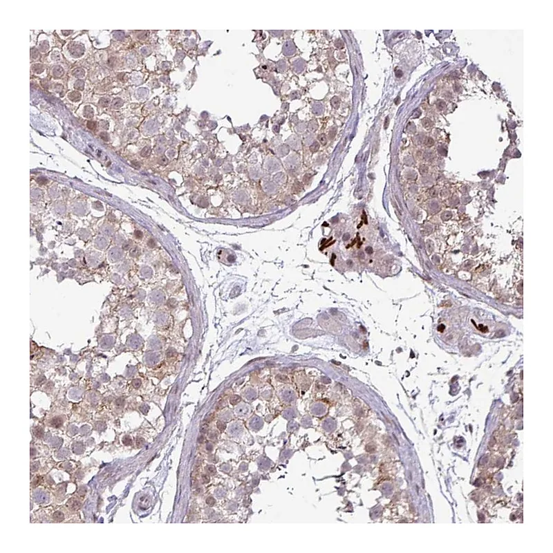 Atlas Antibodies Anti-NOTCH2 Antibody