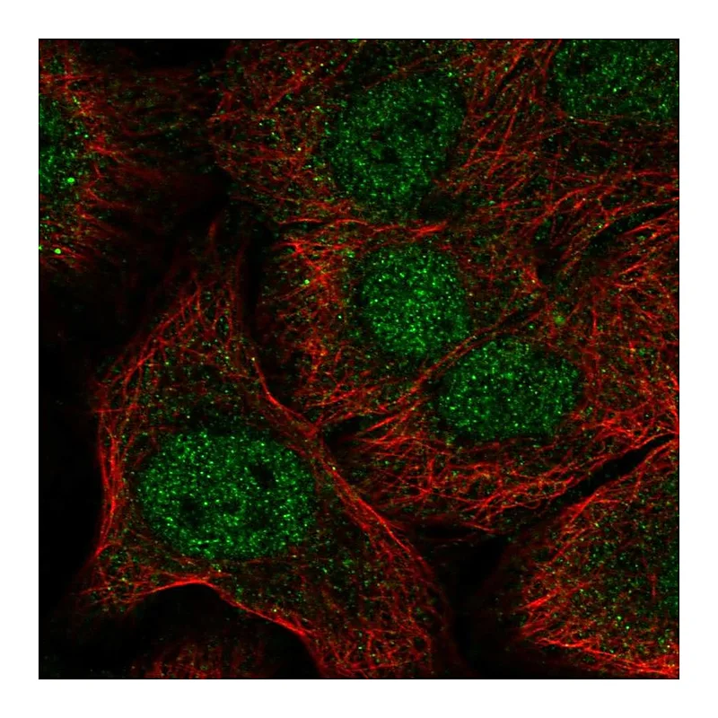 Atlas Antibodies Anti-NOTCH1 Antibody
