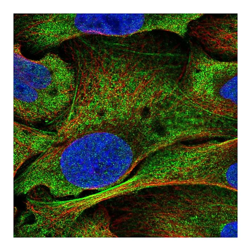 Atlas Antibodies Anti-NOTCH3 Antibody
