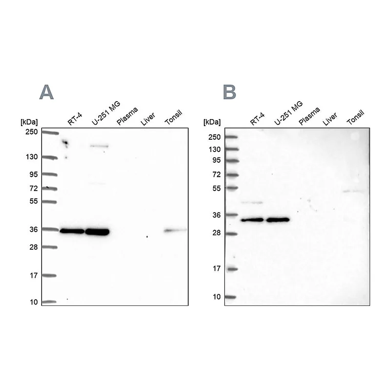 Atlas Antibodies Anti-NOSIP Antibody