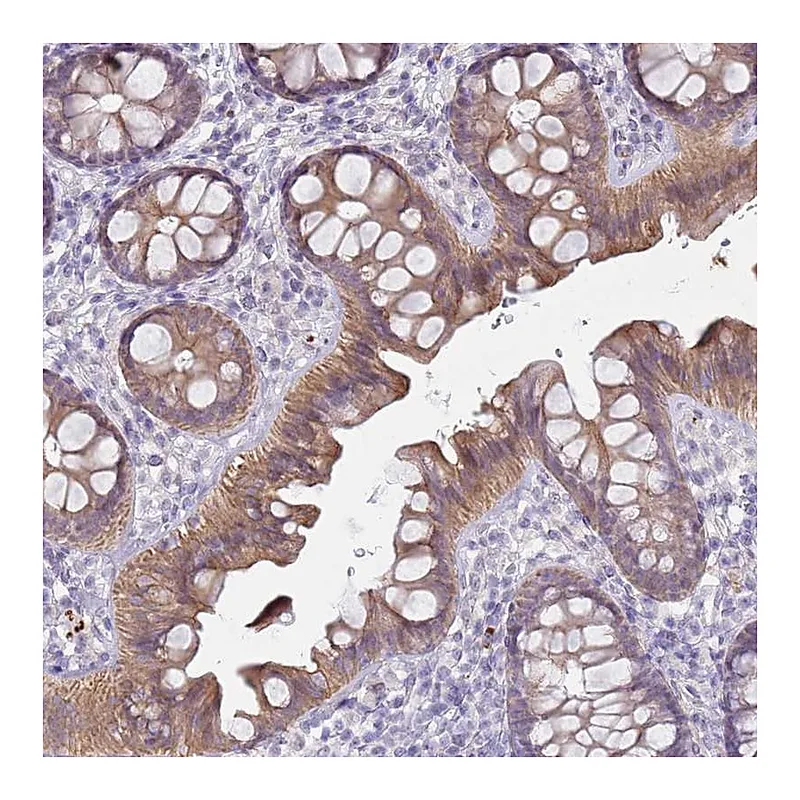 Atlas Antibodies Anti-NPAP1 Antibody
