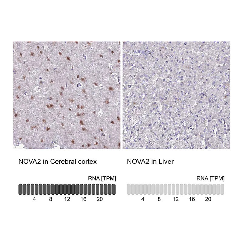 Atlas Antibodies Anti-NOVA2 Antibody
