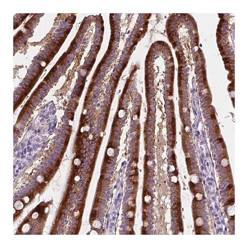 Atlas Antibodies Anti-NOXO1 Antibody