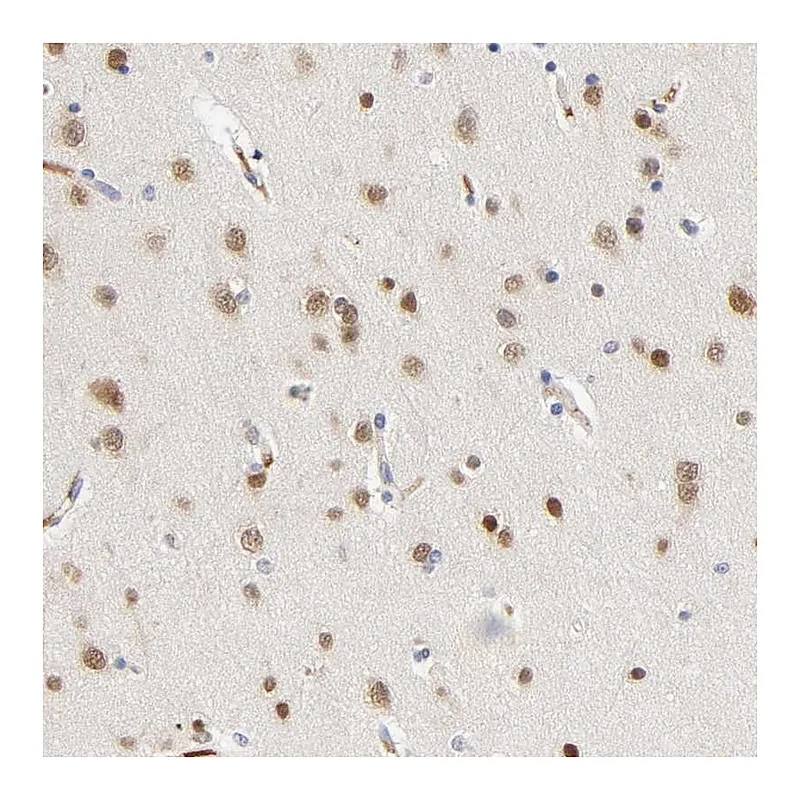 Atlas Antibodies Anti-NOVA1 Antibody