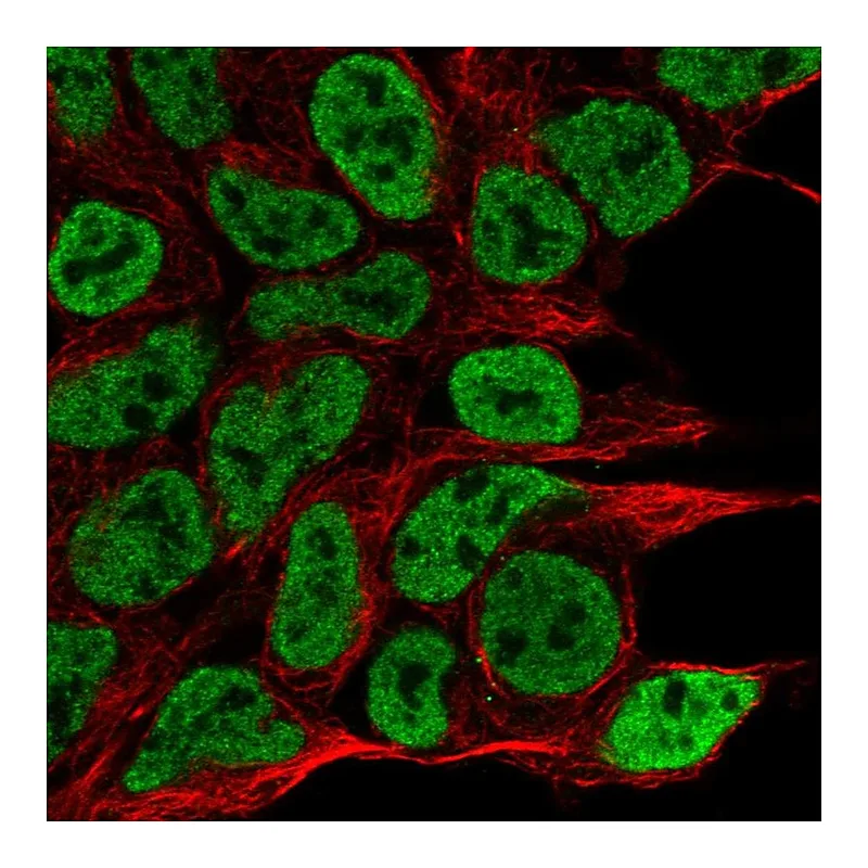 Atlas Antibodies Anti-NPAS1 Antibody