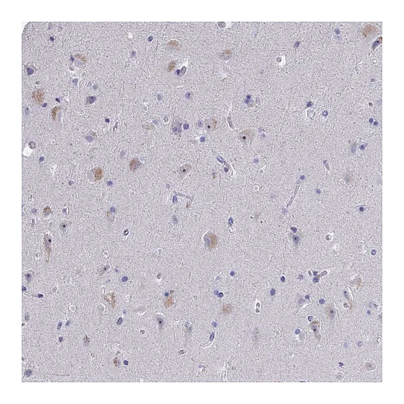Atlas Antibodies Anti-NOXRED1 Antibody