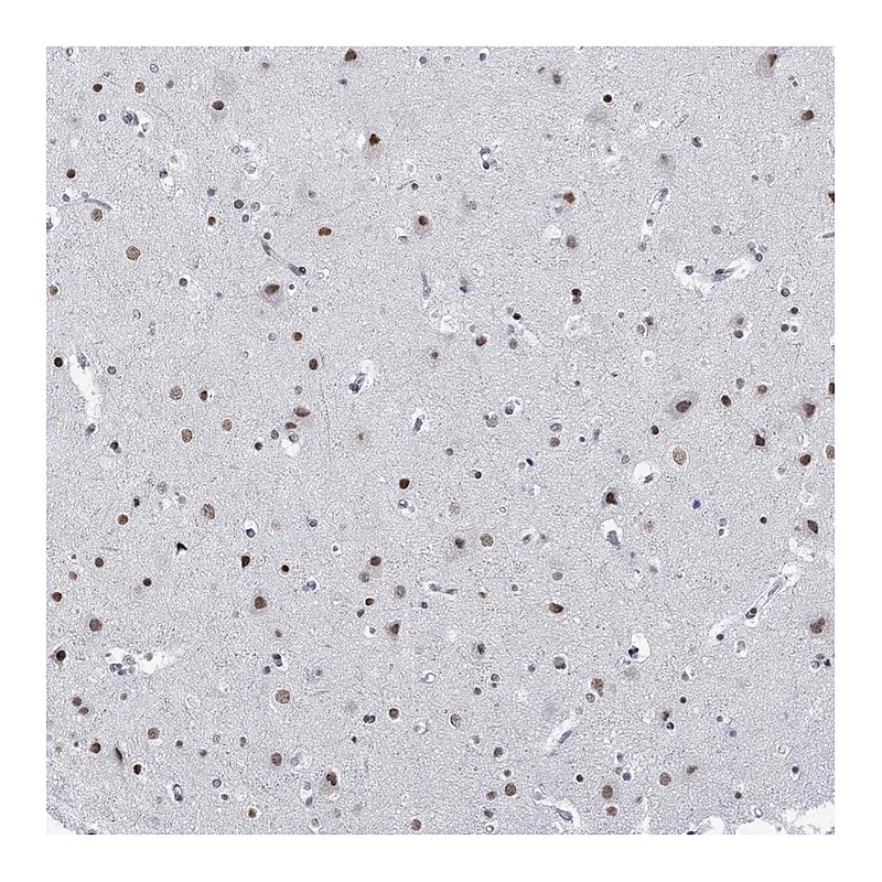 Atlas Antibodies Anti-NPAS3 Antibody