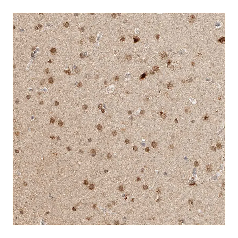 Atlas Antibodies Anti-NPAS2 Antibody