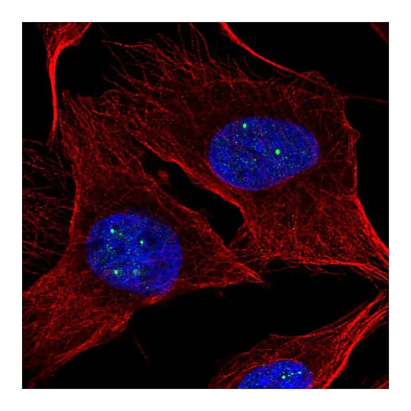 Atlas Antibodies Anti-NPAT Antibody
