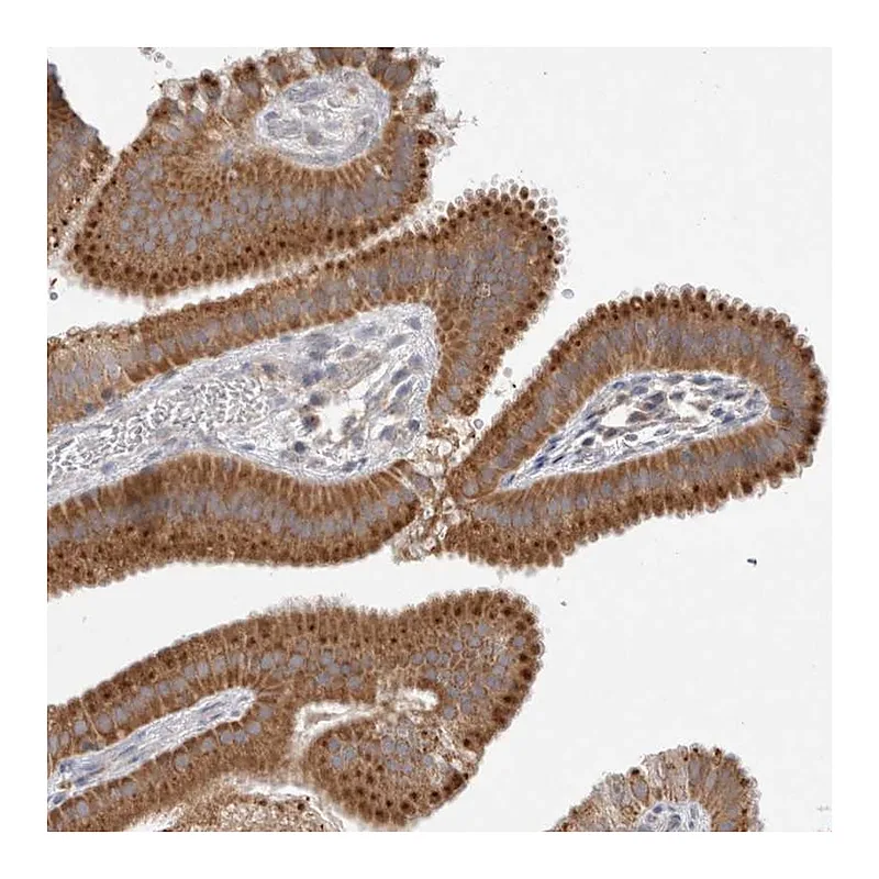 Atlas Antibodies Anti-NPC1 Antibody