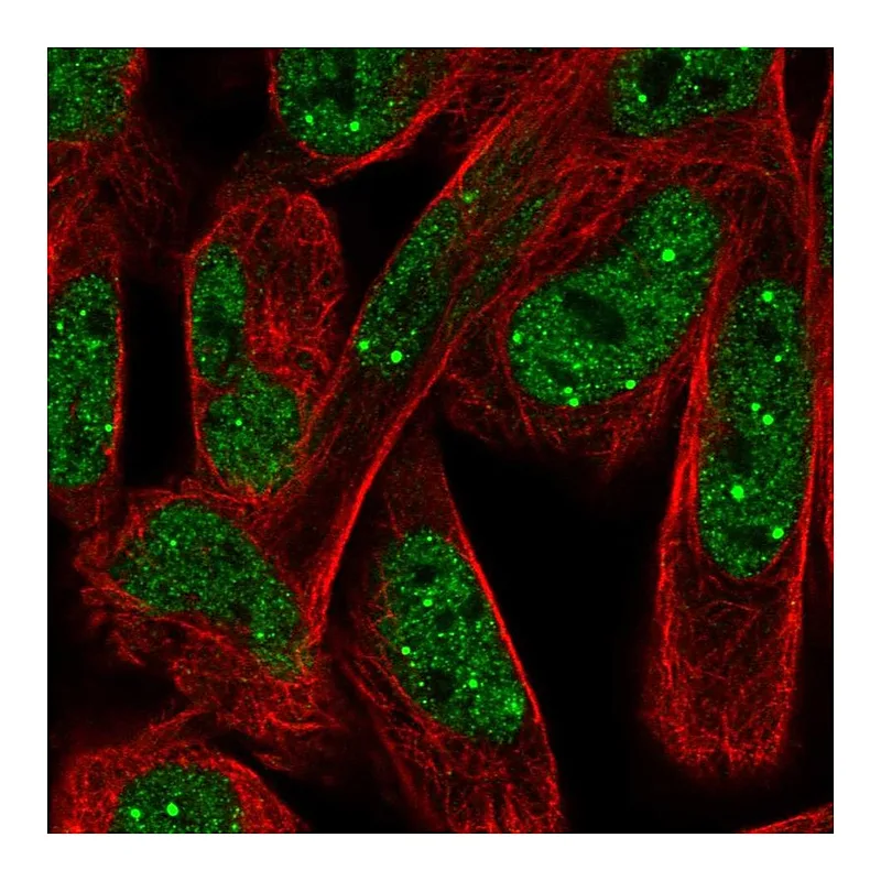 Atlas Antibodies Anti-NPAT Antibody